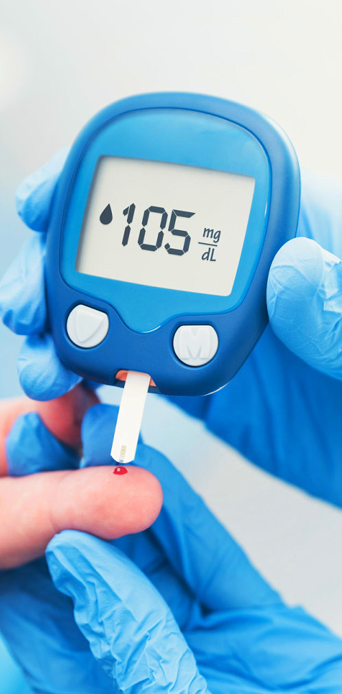 Professional glucose testing